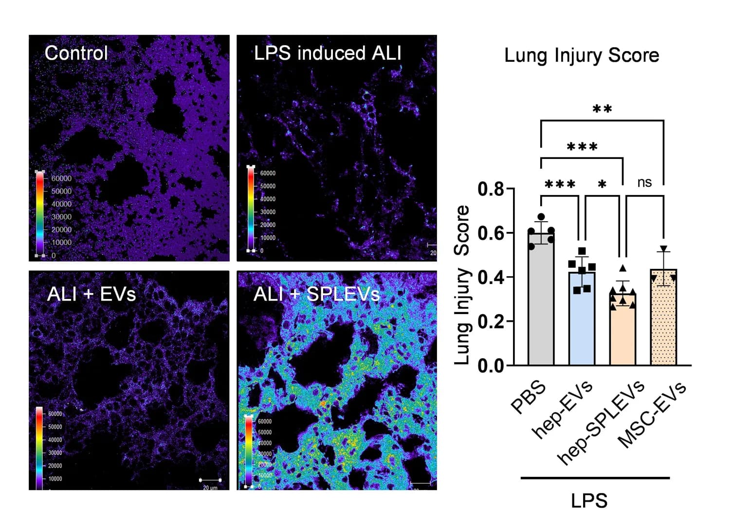 Modified cell vesicles trigger 'lipid counterstorm' against lung inflammation in mice