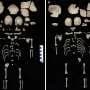 Laid to rest with care: Ancient infants, perhaps twins, found in 1,200-year-old latrine