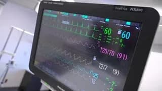 Study finds less invasive heart bypass surgery as good as traditional methods, and patients recovered faster after minimally invasive procedure | Multivessel coronary artery bypass grafting via small