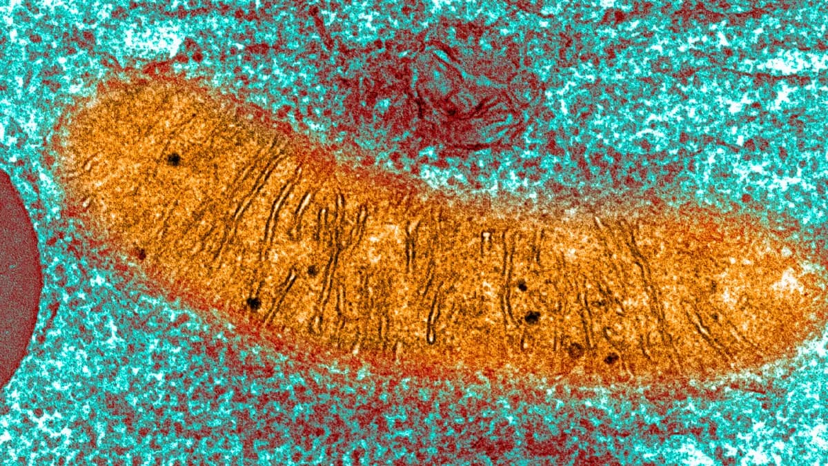 Abnormal New Structure Detected in The Brains Of Humans And Mice With Alzheimer's Disease