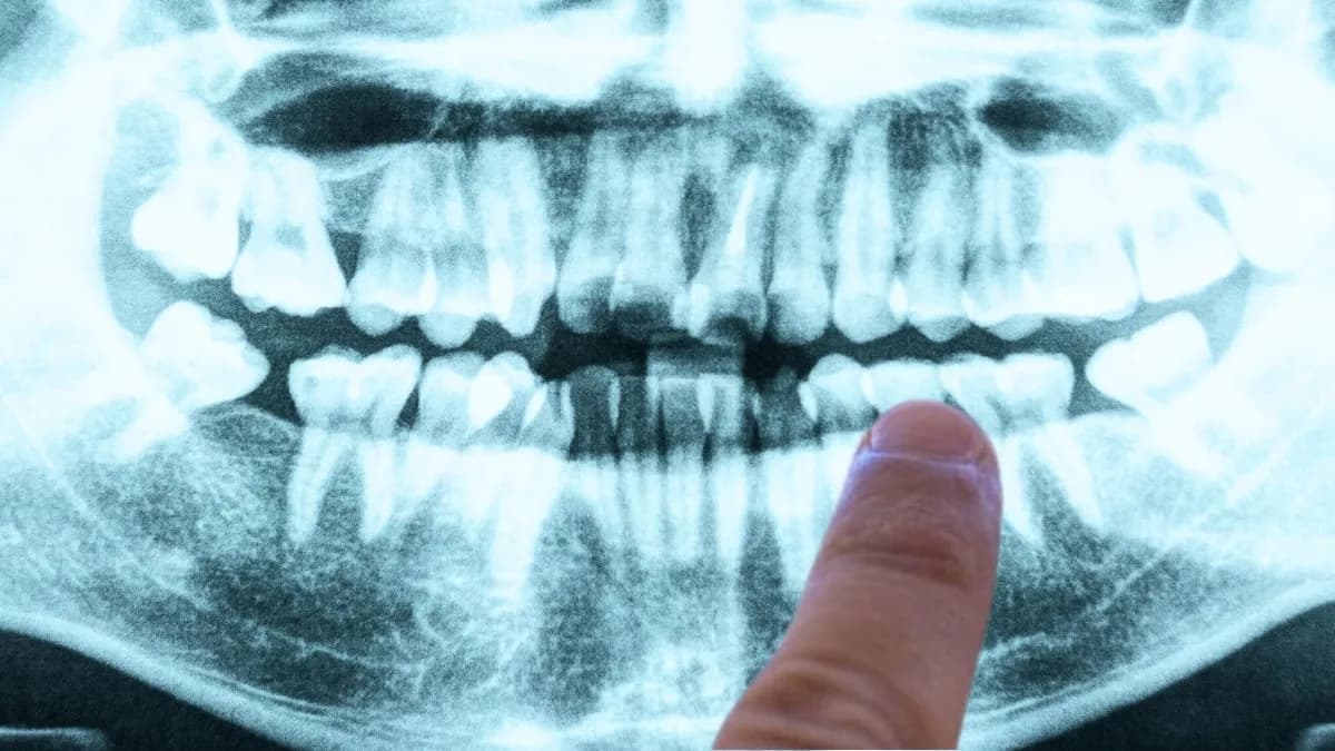 Your Gums May Be Quietly Hinting at a Future Health Risk