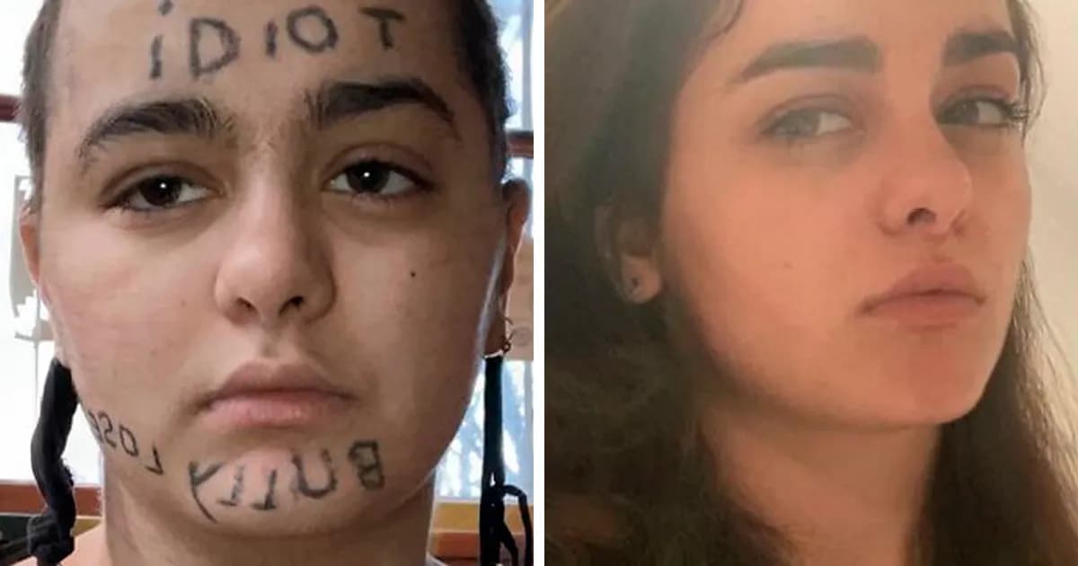 Changed My Life: Photos Before And After Tattoo Removal