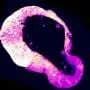 Cells use a little-known molecule to protect themselves from iron overload