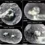 Ruby-forming mineral found by Mars rover hints at violent impacts