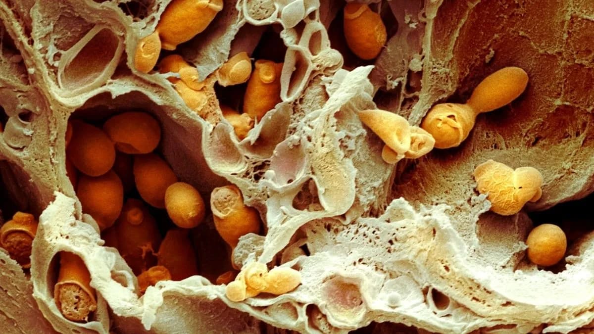 Deadly, Drug-Resistant Fungal Infections Are Spreading – Scientists Just Discovered a Potential Treatment