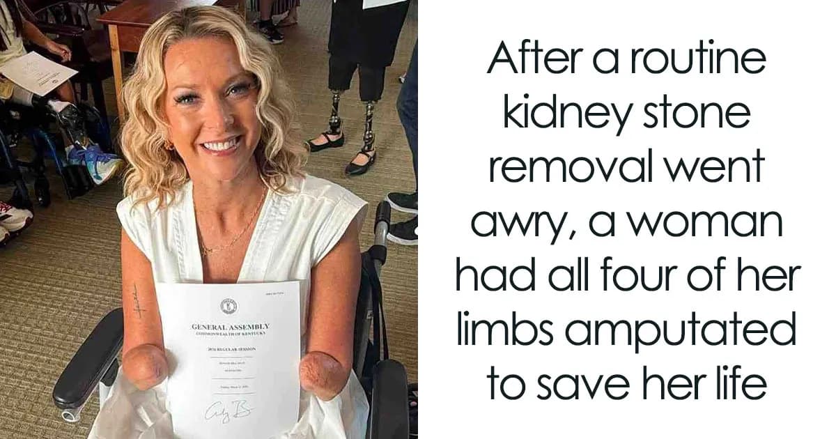 Woman Had Both Legs And Hands Amputated After Routine Surgery, And Her Reaction Moves People