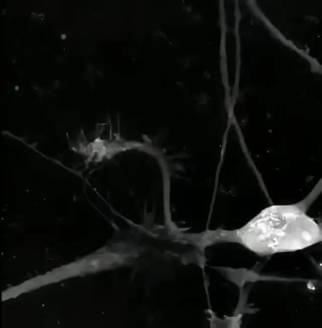 Actual footage of brain rewiring itself