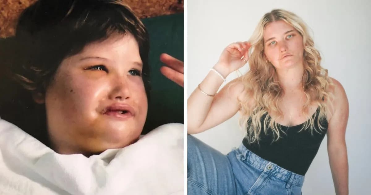 Bizarre Medical Problems And Mysteries That Put People Into The News