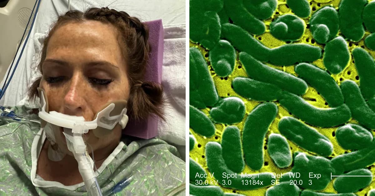 Woman Who Lost āA Lot Of My Legā To Flesh-Eating Bacteria Warns Women About Common Pre-Swim Habit