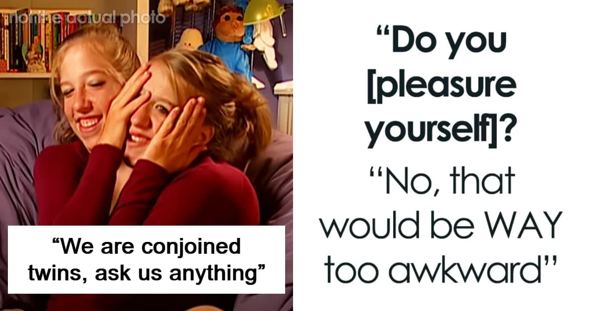 Conjoined Twins Answer Peopleās Most Interesting And Burning Questions