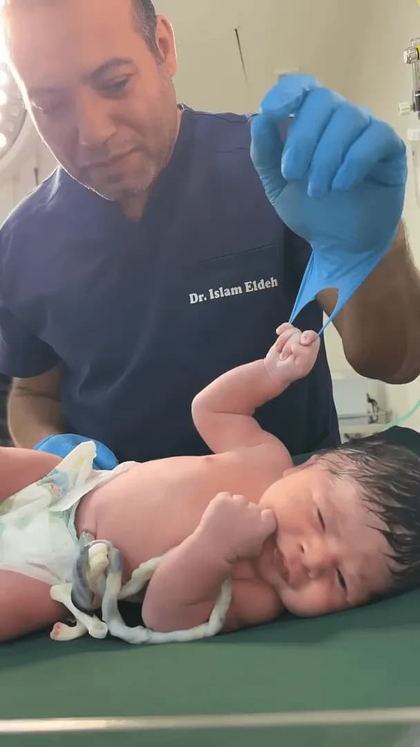 Doctor testing baby palmar grasping reflex.