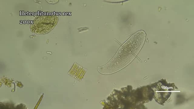 I believe I just became the first person to record this microbe species eat. Heterolitonotus rex kills and engulfs a whole rotifer, plus damages a few hypotrich ciliates.