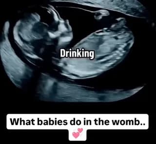 This is the actual behavior of a baby in the womb.
