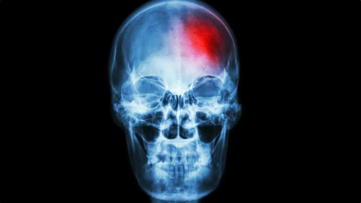 A Hidden Source of Chronic Pain May Be Lurking Inside Your Skull, Study Finds