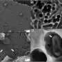 'Pac-Man' enzyme breaks down bioplastics and penicillin in laboratory tests