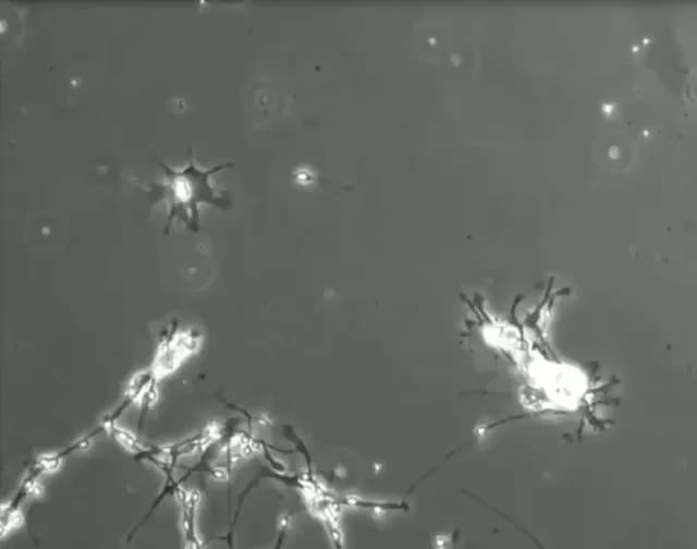 Brain cells in a culture trying to form connections.