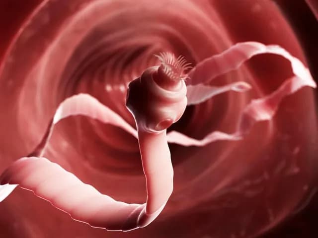 TIL in 2013 a Columbian man with HIV was admitted to the hospital with an aggressive malignant cancer that was not human and from a small tape worm. He died 72 hours later.