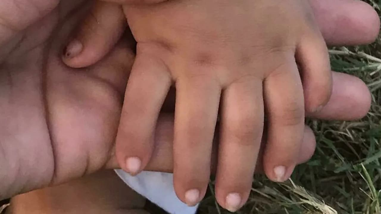 Decades Of Hiding These: 71 Rare And Unexpected Body Quirks People Shared