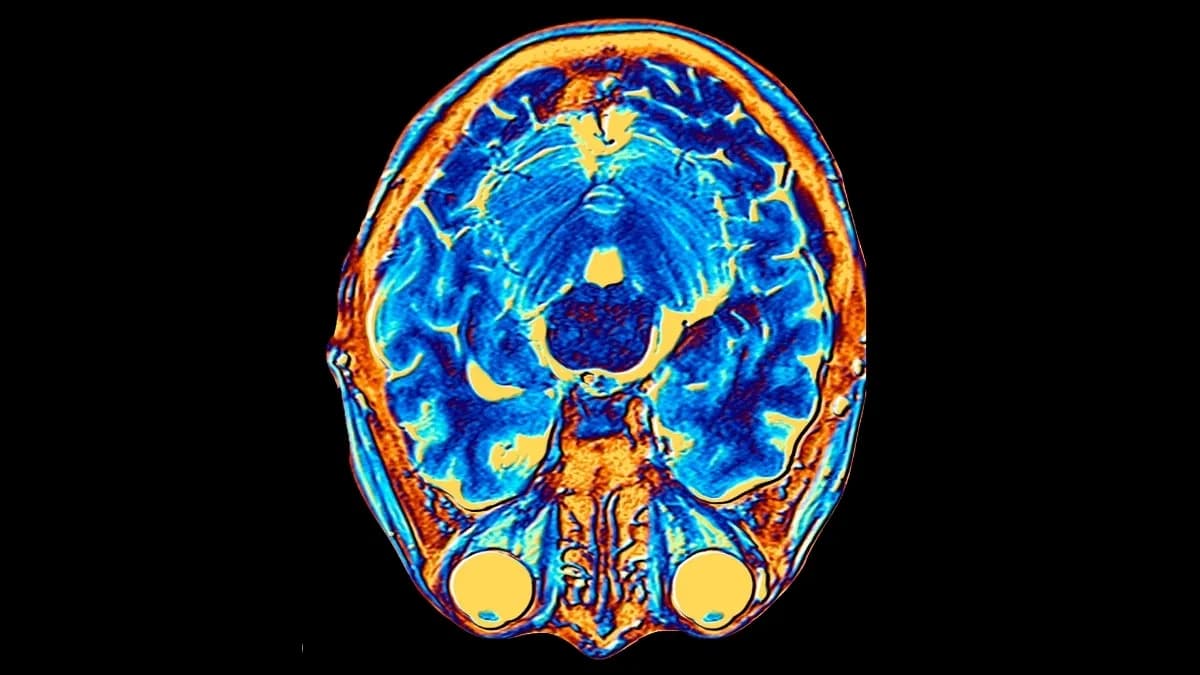 The Human Brain Has Two Distinct Origins, Scientists Discover