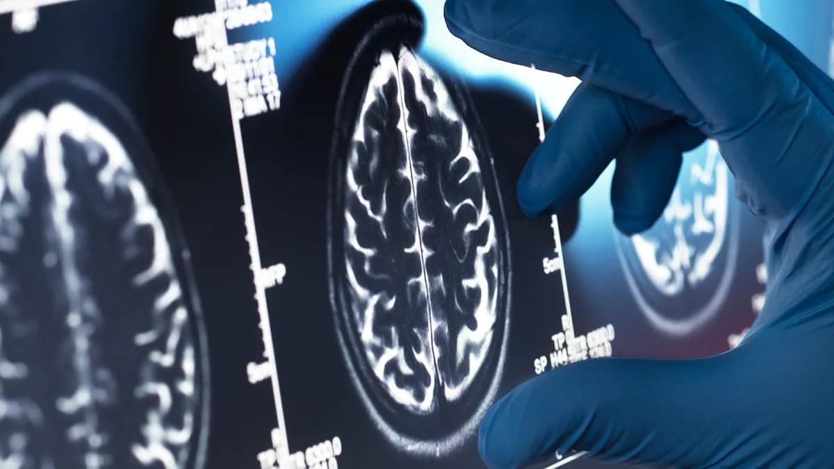 Depression May Affect Two Key Brain Regions &ndash; But Change Is Not Inevitable
