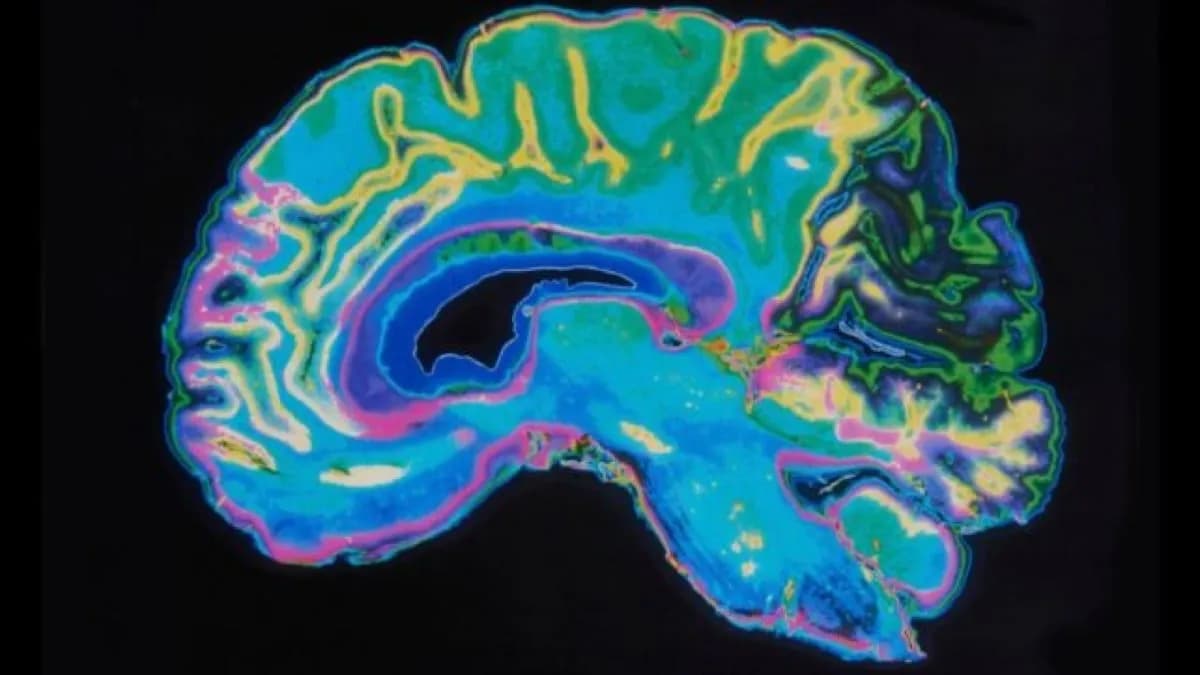 Menopause May Temporarily Alter Your Brain's Normal Aging, Scans Reveal