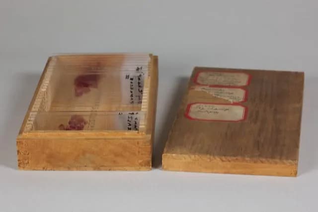 TIL that in 1674, English physician Thomas Willis documented testing for diabetes by tasting patients’ urine, noting that diabetic urine could taste “wonderfully sweet” like honey or sugar