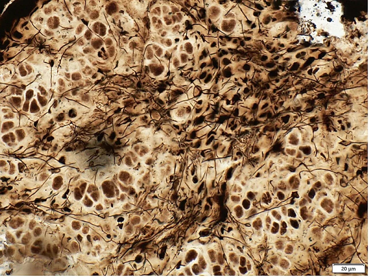 Lichen-like life 600 million years ago may push back origins of fungal-algal partnerships