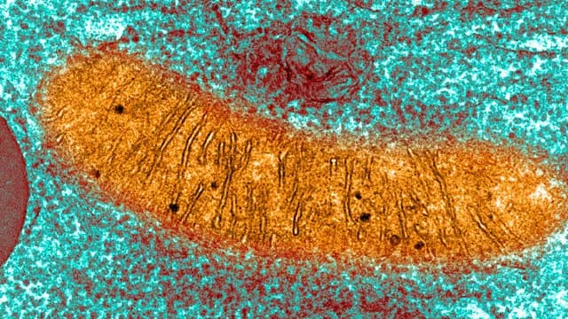 Unexpected structure detected in the brains of humans and mice with Alzheimer’s disease - scientists pinpointed an entirely new pathological basis for the disease: an accumulation of mitochondrial pla