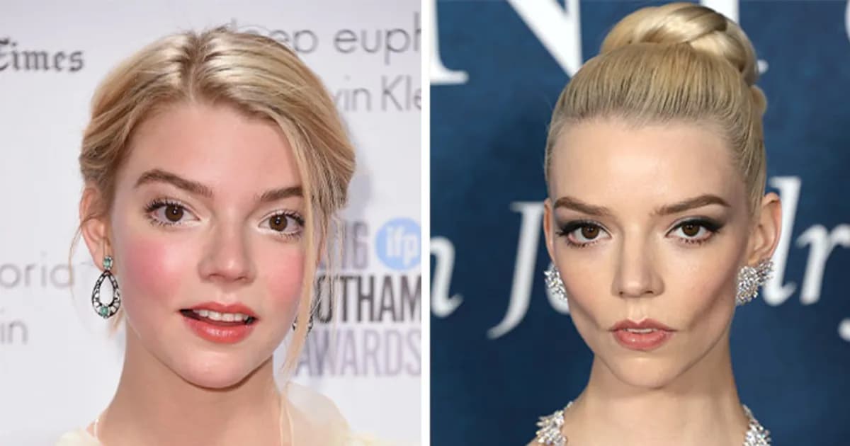 27 Celebrities Fans Believe Ruined Their Beauty With Buccal Fat Removal