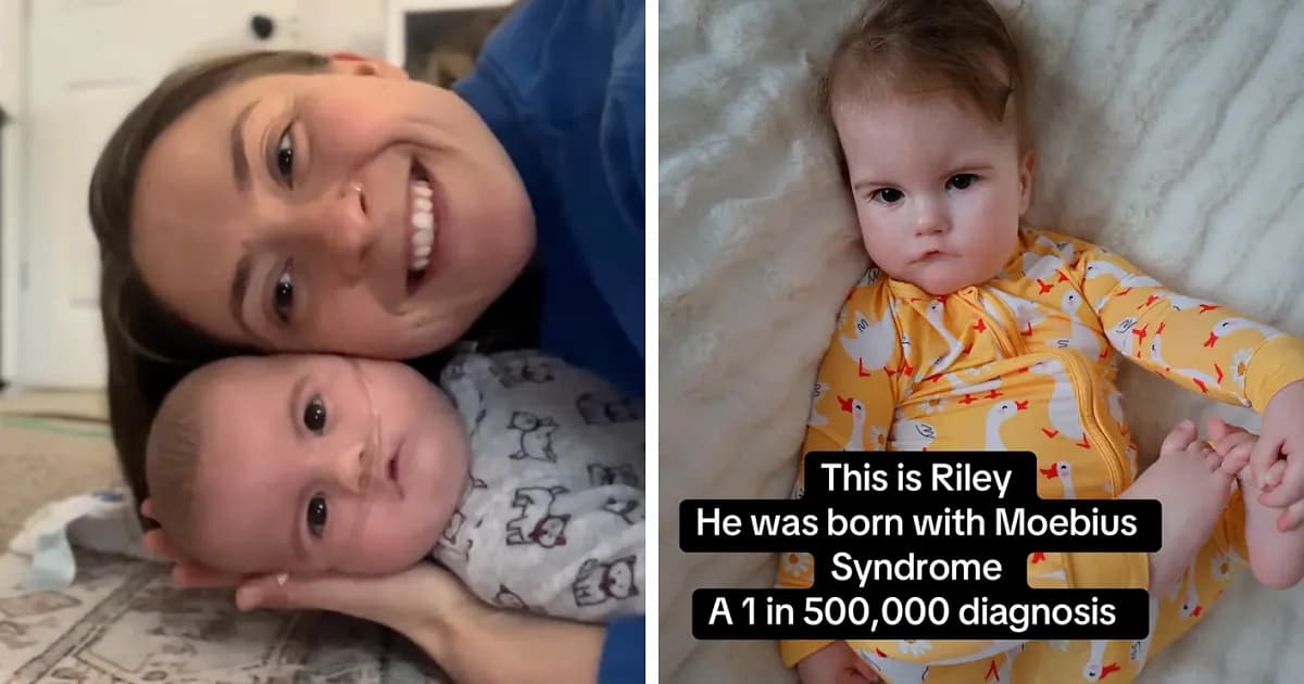 Mom Knew Something Was Wrong When Her Baby Couldnāt Form Expressions, Then Doctors Discovered A Rare Condition
