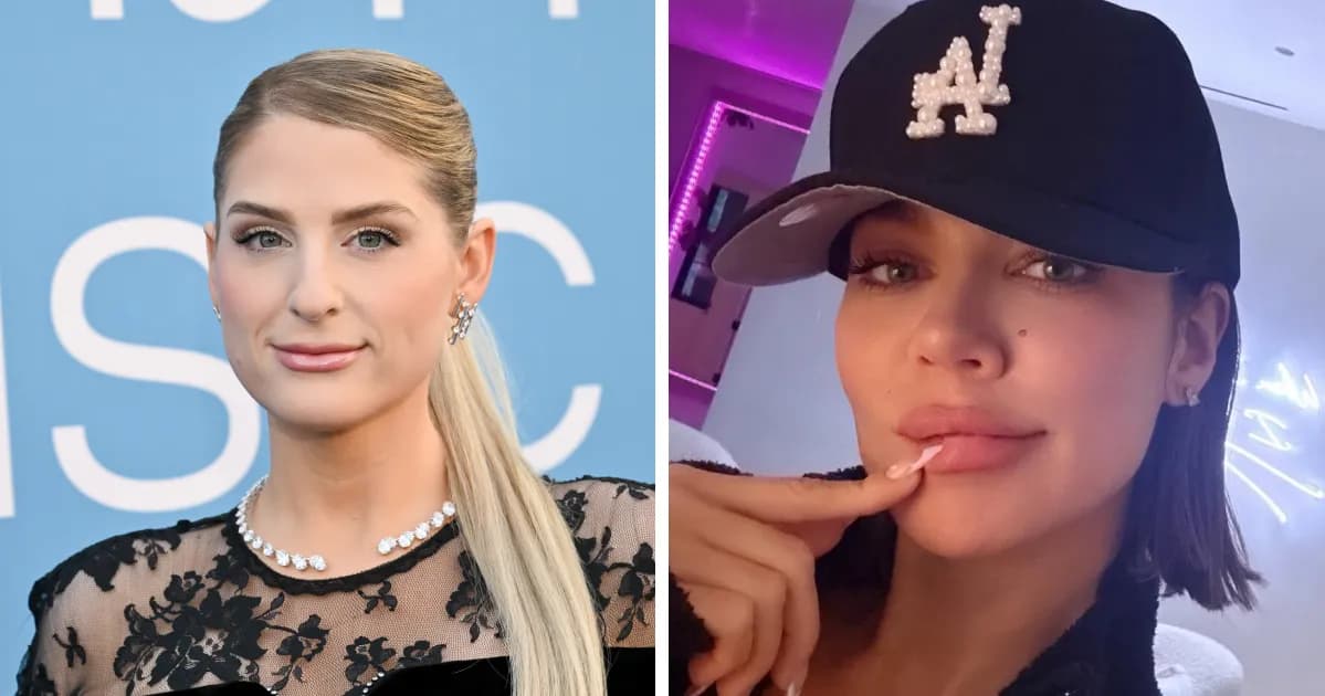 26 Celebrities Before-And-After Photos: Moving From Botox To āLip Flipā