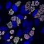 Toxoplasma parasite reveals an unusual strategy for surviving crowded environments in infected cells