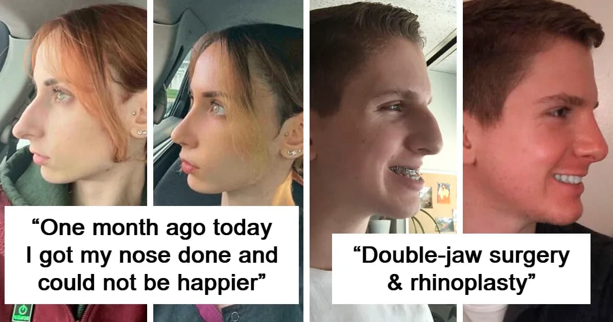 People Who Look Unrecognizable After Plastic Surgery