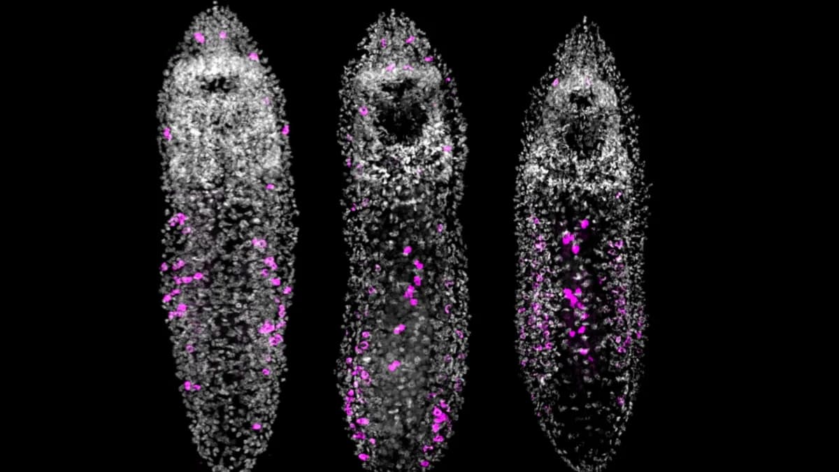 Scientists Overfed a Tiny Worm... And It Started Growing a Chain of Clones