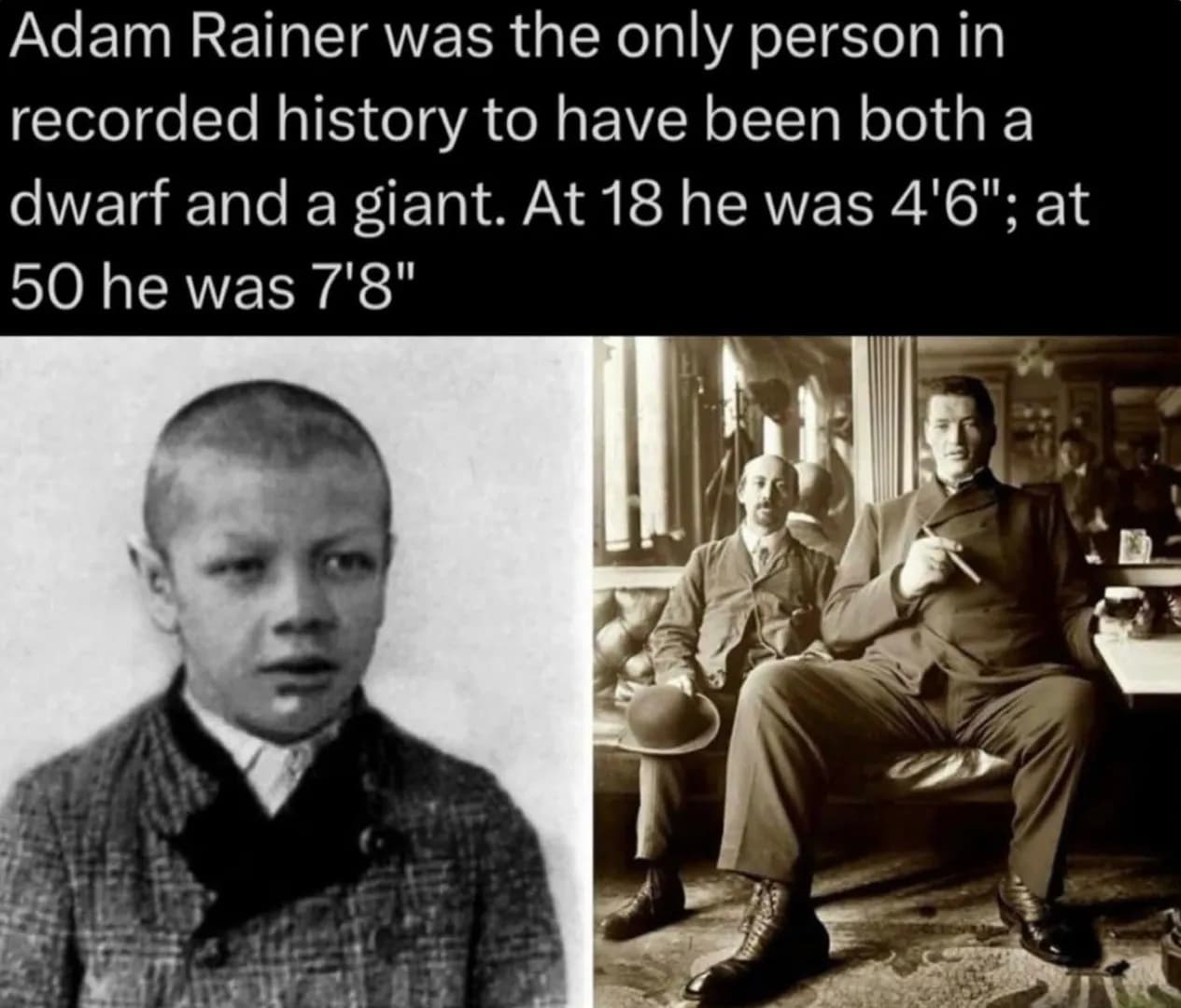 The only man to be both a dwarf and a giant in his lifetime