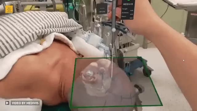 Using 3D holograms to help doctors get real -time tracking of inside the body.