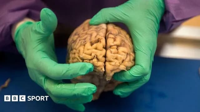 NFL: At least one in four dead players had brain disease, says study