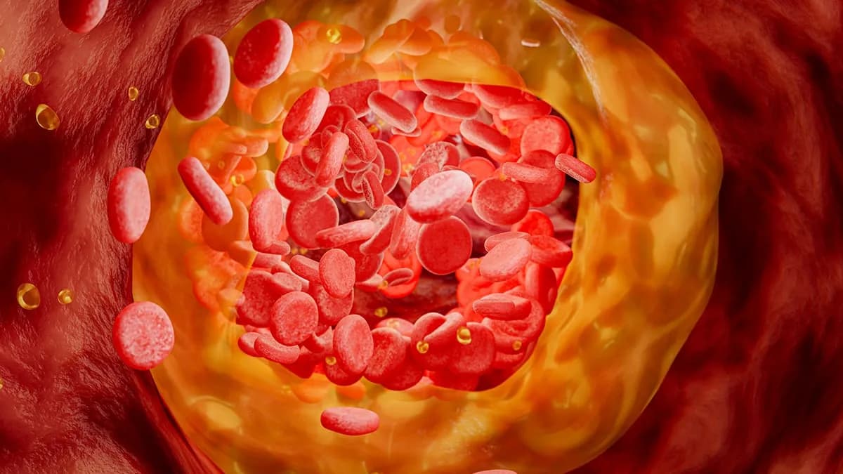 Experimental One-Dose Treatment Cuts 'Bad' Cholesterol by 52% in First Human Trial