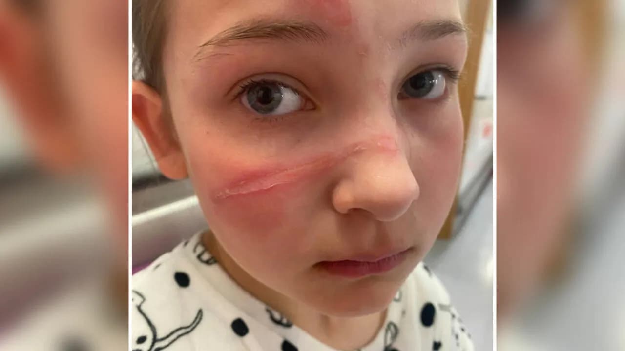 Popular Squishy Toys Pulled From Market After Children Are Hospitalized With Serious Injuries