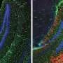 Ubiquitin marks abnormal glycogen for destruction to protect the brain, study finds