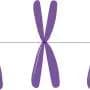 Loss of Y chromosome in men could be an early warning sign of cancer